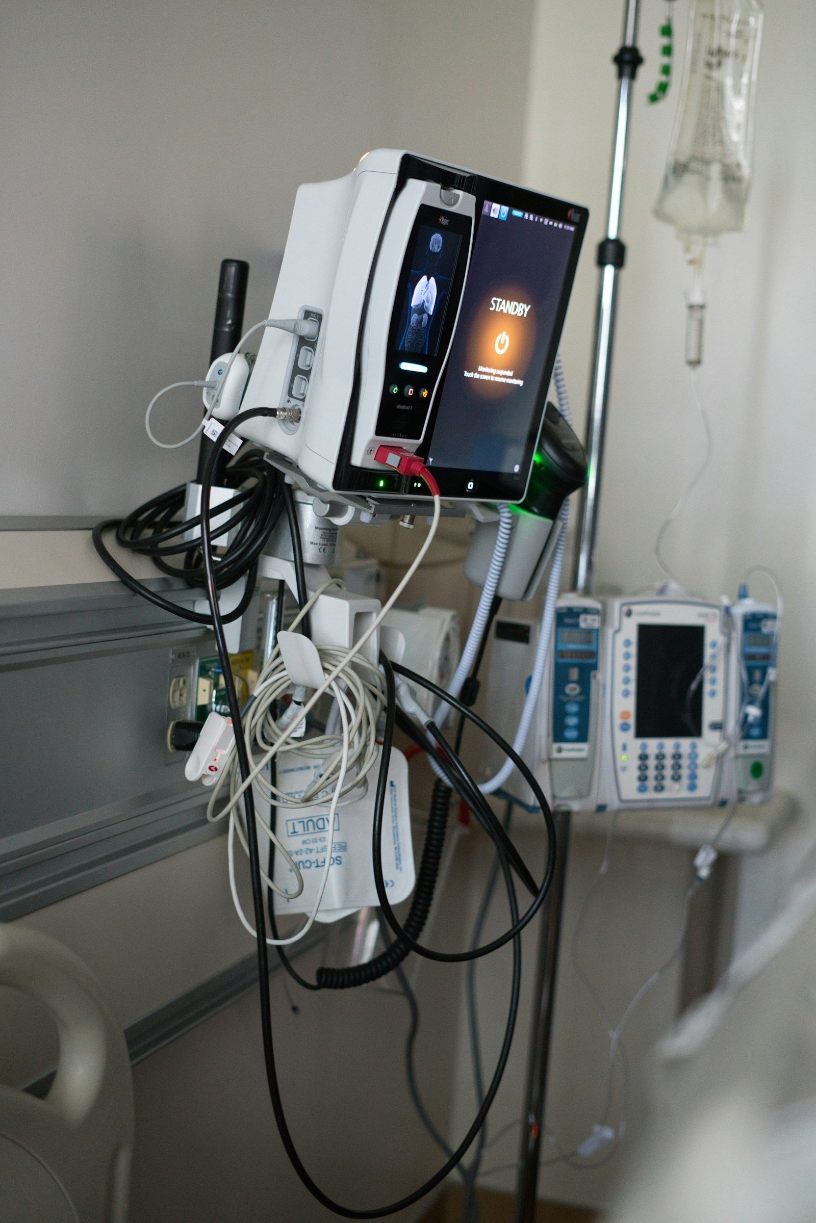 Medical monitoring equipment in a hospital room